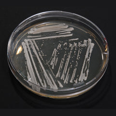 Yeast Media